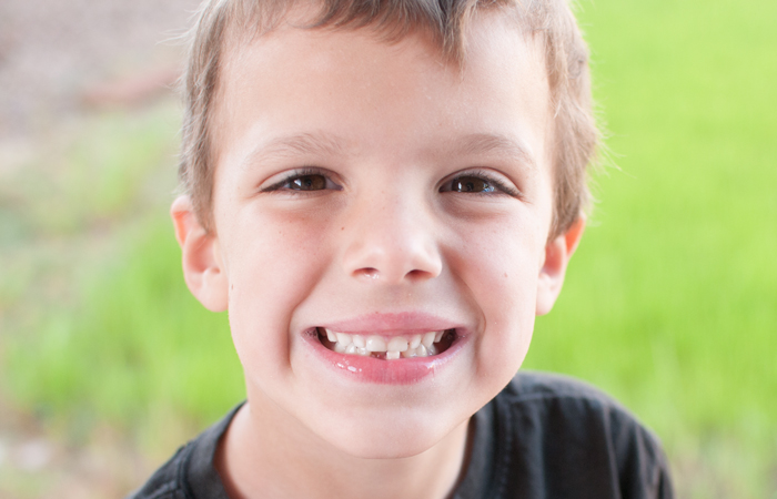 How To Take Pictures of that First Lost Tooth - SnapHappyMom.com