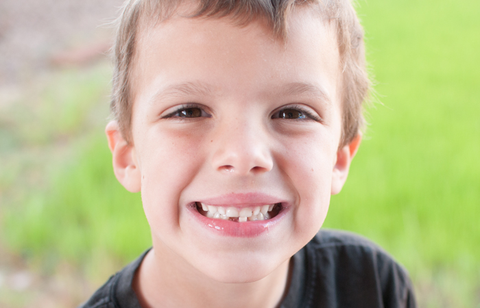 How To Take Pictures of that First Lost Tooth - Snap Happy Mom