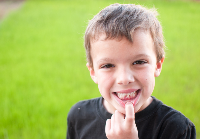 How To Take Pictures of that First Lost Tooth - SnapHappyMom.com